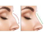 جراحی زیبایی بینی | عمل بینی |  لیفت سینه | لیپوماتیک