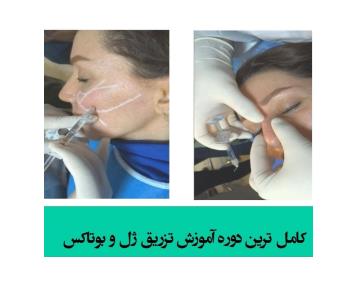آموزش تزریق ژل و بوتاکس در شهر شیراز 