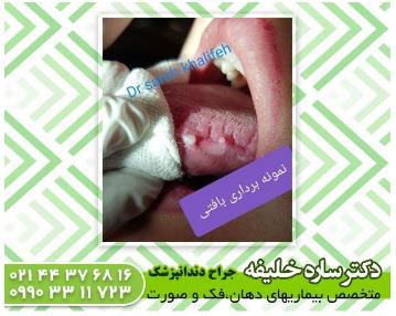 متخصص بیماری های دهان در غرب تهران 