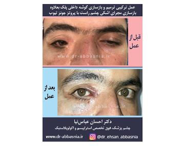 بهترین جراح متخصص چشم پزشک در سعادت آباد