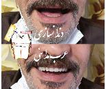 دندانسازی در کرمان
