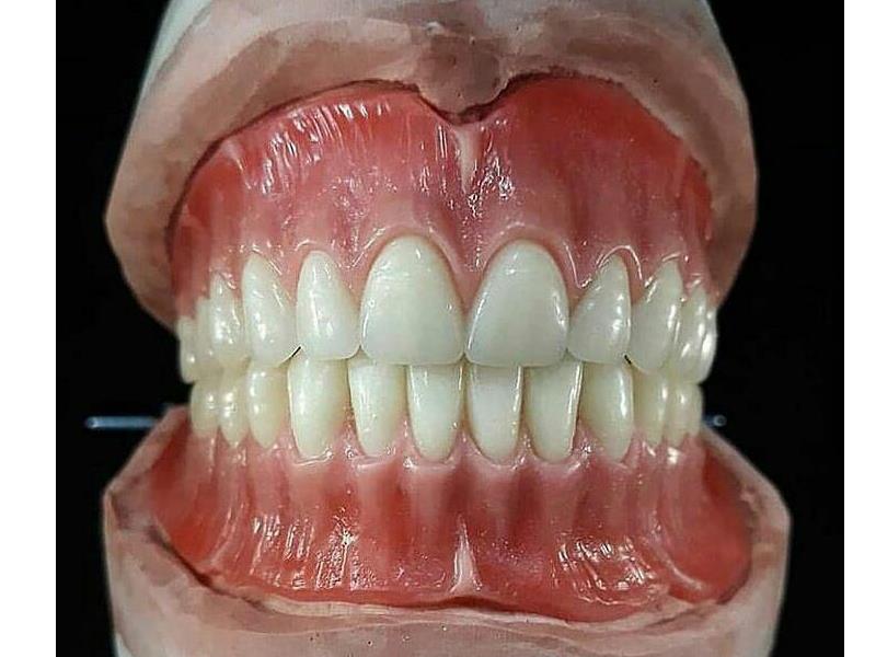 دندانسازی داریس(غفاری)