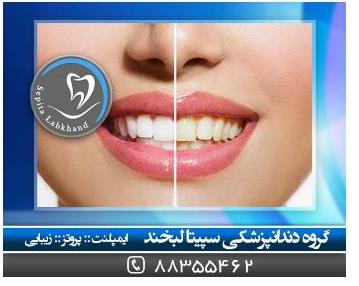 دندانپزشکی در میرزای شیرازی