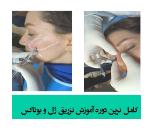 آموزش تزریق ژل و بوتاکس در شهر شیراز 