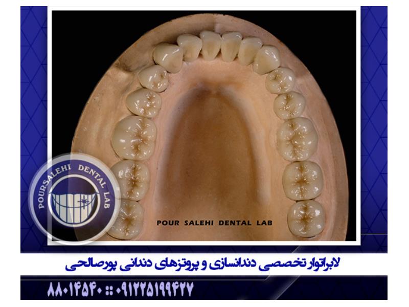 لابراتوار تخصصی دندانسازی و پروتزهای دندانی پورصالحی