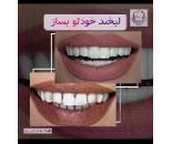 کلینیک دندانپزشکی لیمنیت دندان در منطقه22