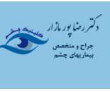 بهترین چشم پزشک در غرب تهران 