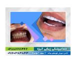 متخصص ترمیم و زیبایی دندان در ولنجک
