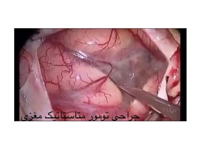  دکتر محمد اسماعیلی متخصص جراحی مغز و اعصاب و ستون فقرات در زعفرانیه,منطقه 1