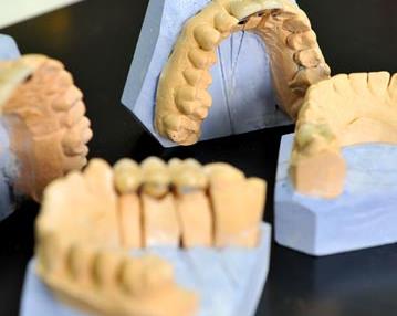 بهترین خدمات پزشکی دندان مصنوعی در اصفهان